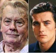 الآن ديلون والموت الرحيم