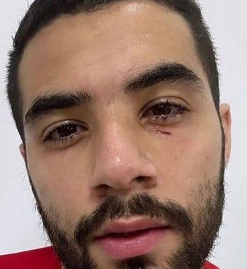 شاهد .. مها أحمد بصورة مفاجئة لإبنها..تعرّض لإصابة والجمهور يدعو له