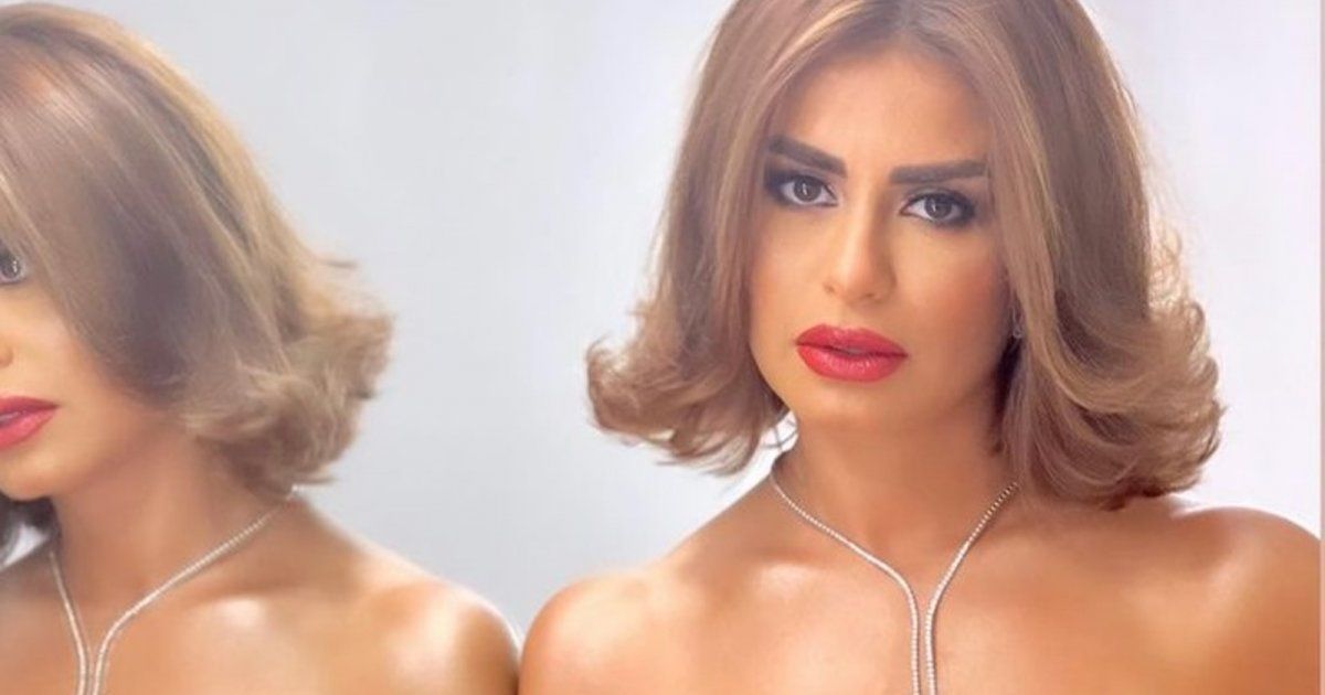 شاهد .. منة فضالي تثير دهشة كثيرين بتغيير ملامحها - بالصور