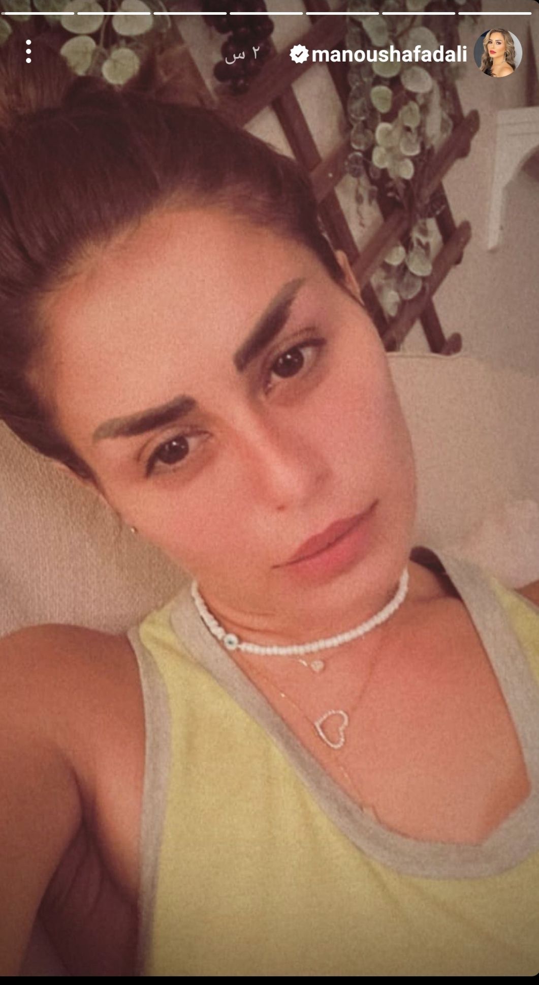 منة فضالي تتألق بإطلالة صباحية مشرقة في احدث ظهور لها- شاهد