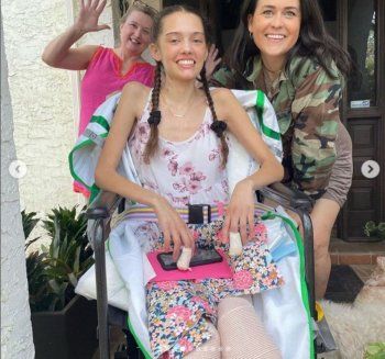 شاهد .. بالصور- عارضة أزياء تفقد ساقيها لهذا السبب