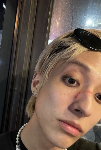 شاهد .. فنان شهير يتعرض للاعتداء بسبب ميوله الجنسية