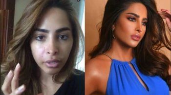 شاهد .. صور قديمة لـ فوز الفهد تعود إلى الواجهة.. وتغيرها الواضح يحدث ضجة