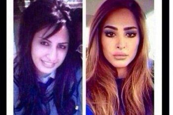 شاهد .. صور قديمة لـ فوز الفهد تعود إلى الواجهة.. وتغيرها الواضح يحدث ضجة