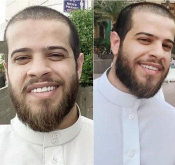 شاهد .. أدهم نابلسي يتخلى عن شعره ويفاجئ الجمهور بأحدث ظهور له - بالصورة
