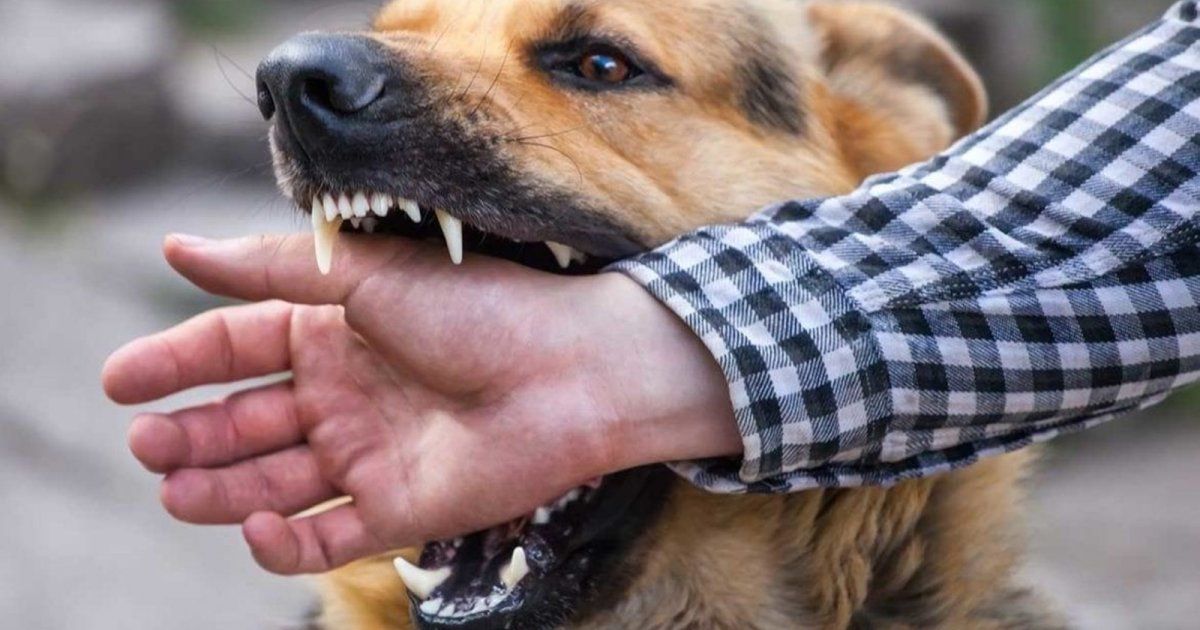 شاهد .. قبل رحمة حسن..مشاهير تعرضوا لعضة كلب