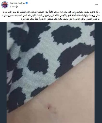 بالصور – محاولة خطف ابنة شقيق الفنانة بدرية طلبة