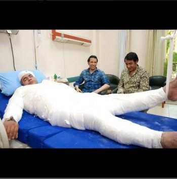 شاهد .. بالصورة- ما حقيقة تعرض بيومي فؤاد لكسور في جسده ودخوله المستشفى