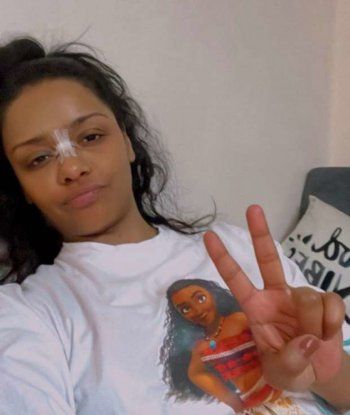 شاهد .. بالصورة- أسماء أبو اليزيد تثير الجدل بإصابتها في أنفها