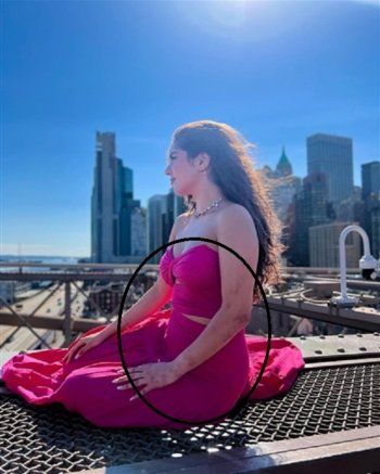 شاهد .. بالصورة - كدمات وجروح كبيرة على يدها... هل تعرضت مايان السيد للضرب؟