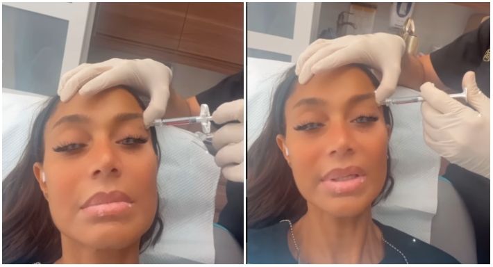 بالفيديو – بسمة وهبة تخضع لحقن فيلر بسبب جلدها