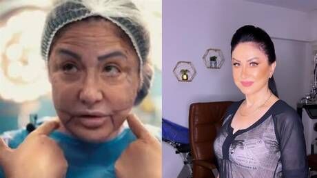 خبر صادم: تشوه وجه الجميلة وفاء سالم.. شاهد كيف أصبحت!