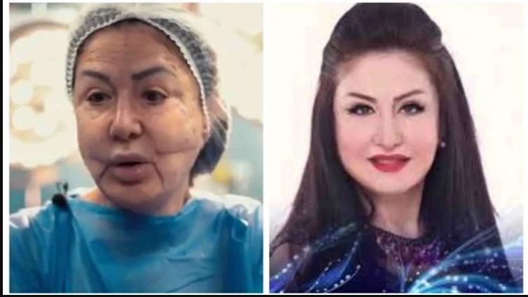 وفاء سالم جميلة الجميلات تشوه وجهها بالكامل : هتتخض من شكلها – صورة