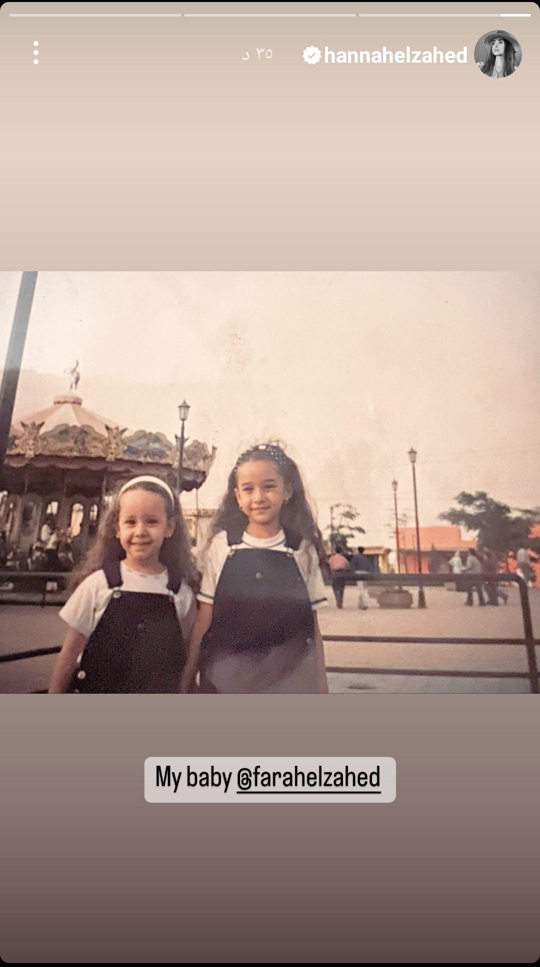 بصور من الطفولة.. هنا الزاهد تتغزل في شقيقتها فرح – شاهد