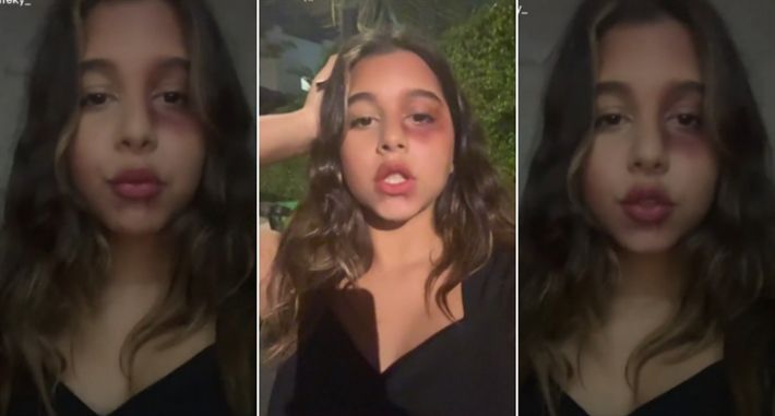 بالصور – اللي حصل في بنت شيرين علقة موت ولا ميك أب