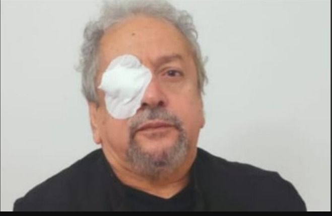 إصابة خطيرة .. تعرض المخرج عمر عبد العزيز للإنفصال الشبكي في عينه