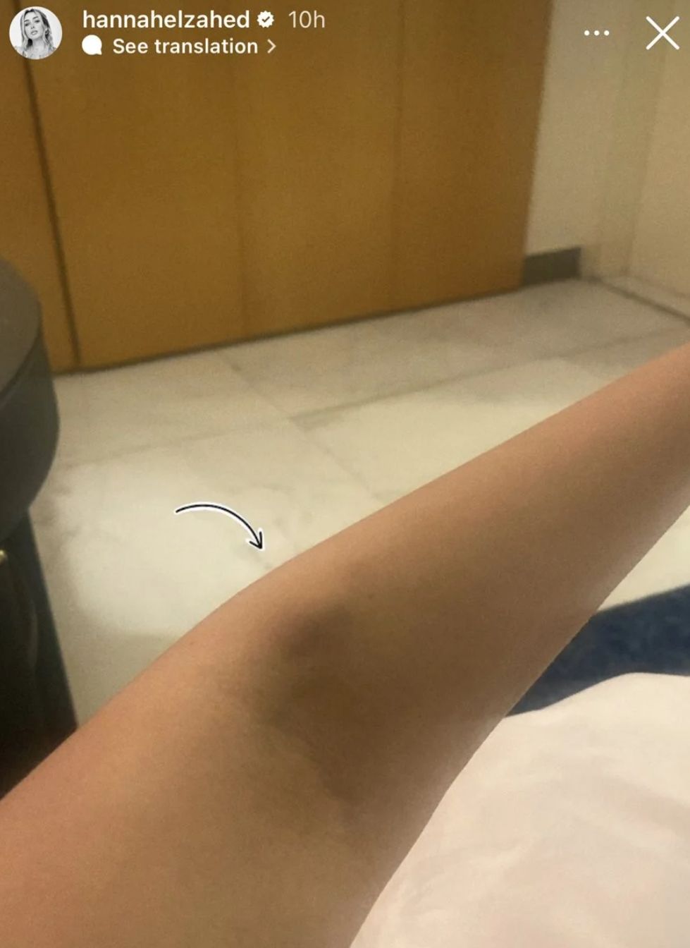 بالصور : هنا الزاهد تعبانة في لبنان ودخلت المستشفي