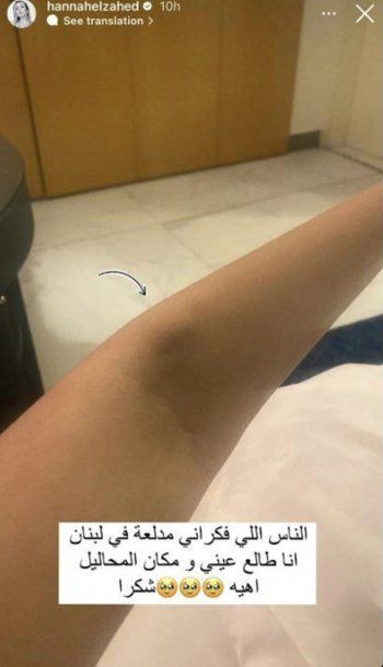 شاهد .. بالصورة- هنا الزاهد تتعرض لوعكة صحية في لبنان وتدخل المستشفى