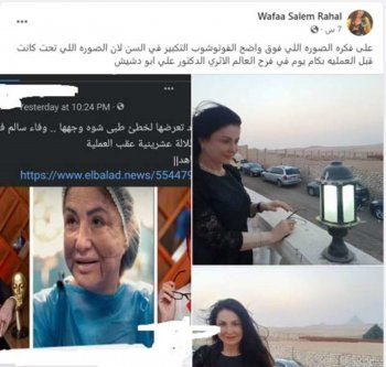 شاهد .. وفاء سالم تعلق على الصورة التي انتشرت لها من داخل المستشفى