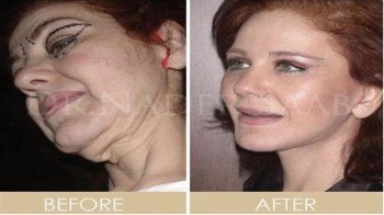 شاهد .. ميادة الحناوي تتصدر الترند بأحدث ظهور لها.. وتفاجئ الجمهور بتغير ملامحها