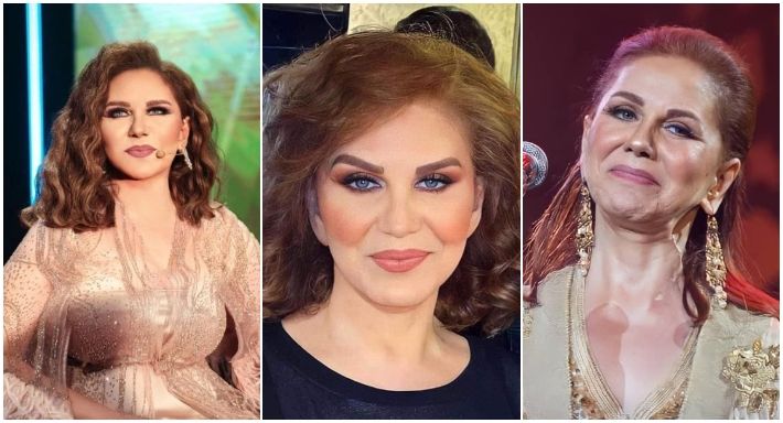 بالصور – ” ميادة الحناوي ” قبل وبعد عملية التجميل