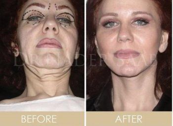 شاهد .. ميادة الحناوي تتصدر الترند بأحدث ظهور لها.. وتفاجئ الجمهور بتغير ملامحها