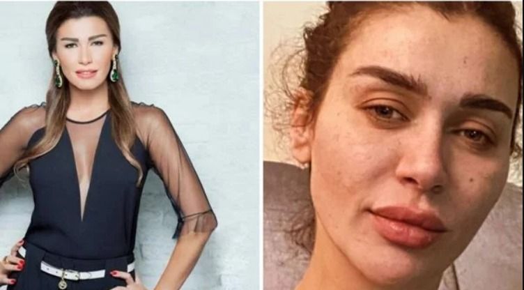 دبلت العيون وجفت الورود .. الحزن ينهش في جسد نادين الراسي – صورة