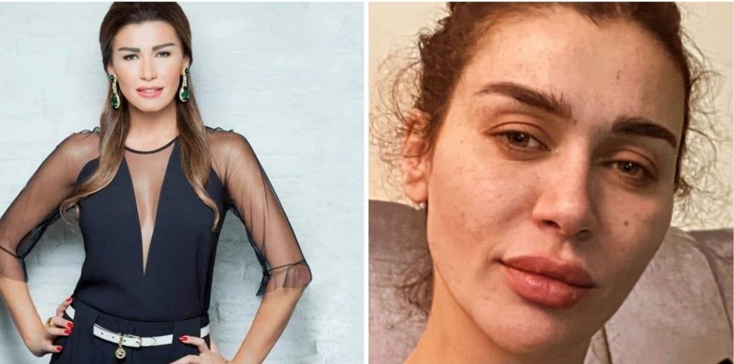 دبلت العيون وجفت الورود .. الحزن ينهش في جسد نادين الراسي – صورة