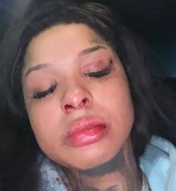 شاهد .. بالصور - جوني ديب هو ليس أول رجل يتعنف على يد حبيبته...هذا الثنائي الشهير يمر بالتجربة نفسها