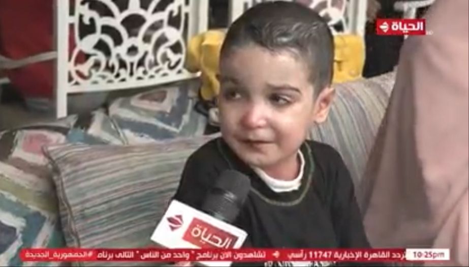 الفنان أحمد شاكر يشارك بحفلة دعم الأطفال مرضى إنحلال الجلد الفقاعي