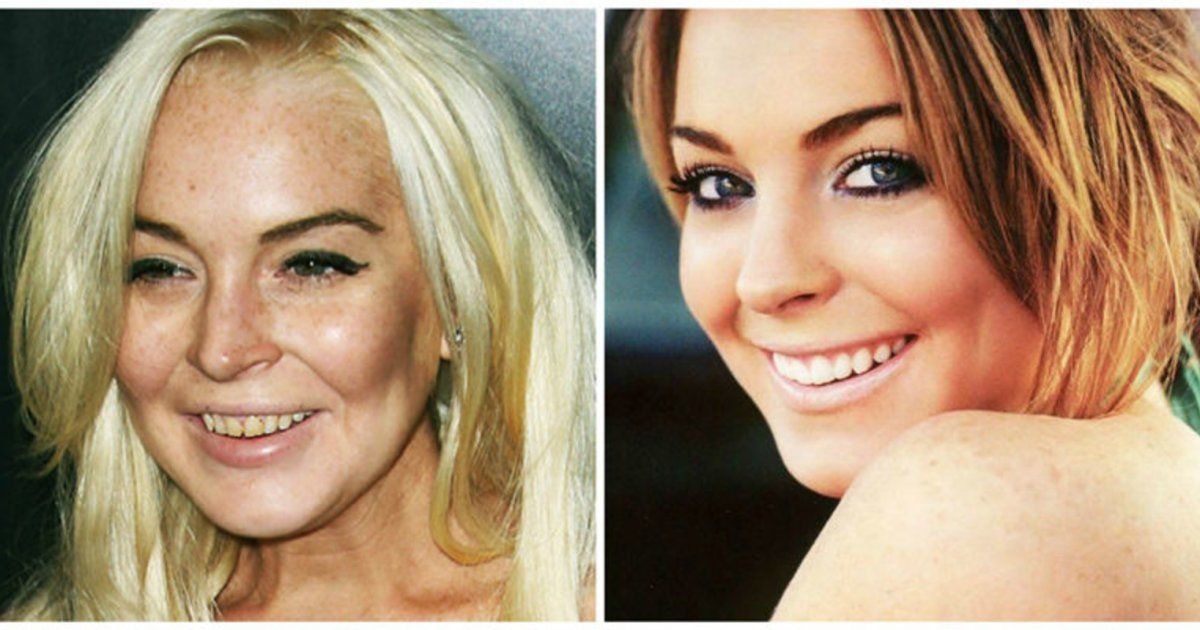 شاهد .. مفاجأة حول هوية المشاهير أصحاب الأسنان متسخة ورائحة الفم البشعة!!