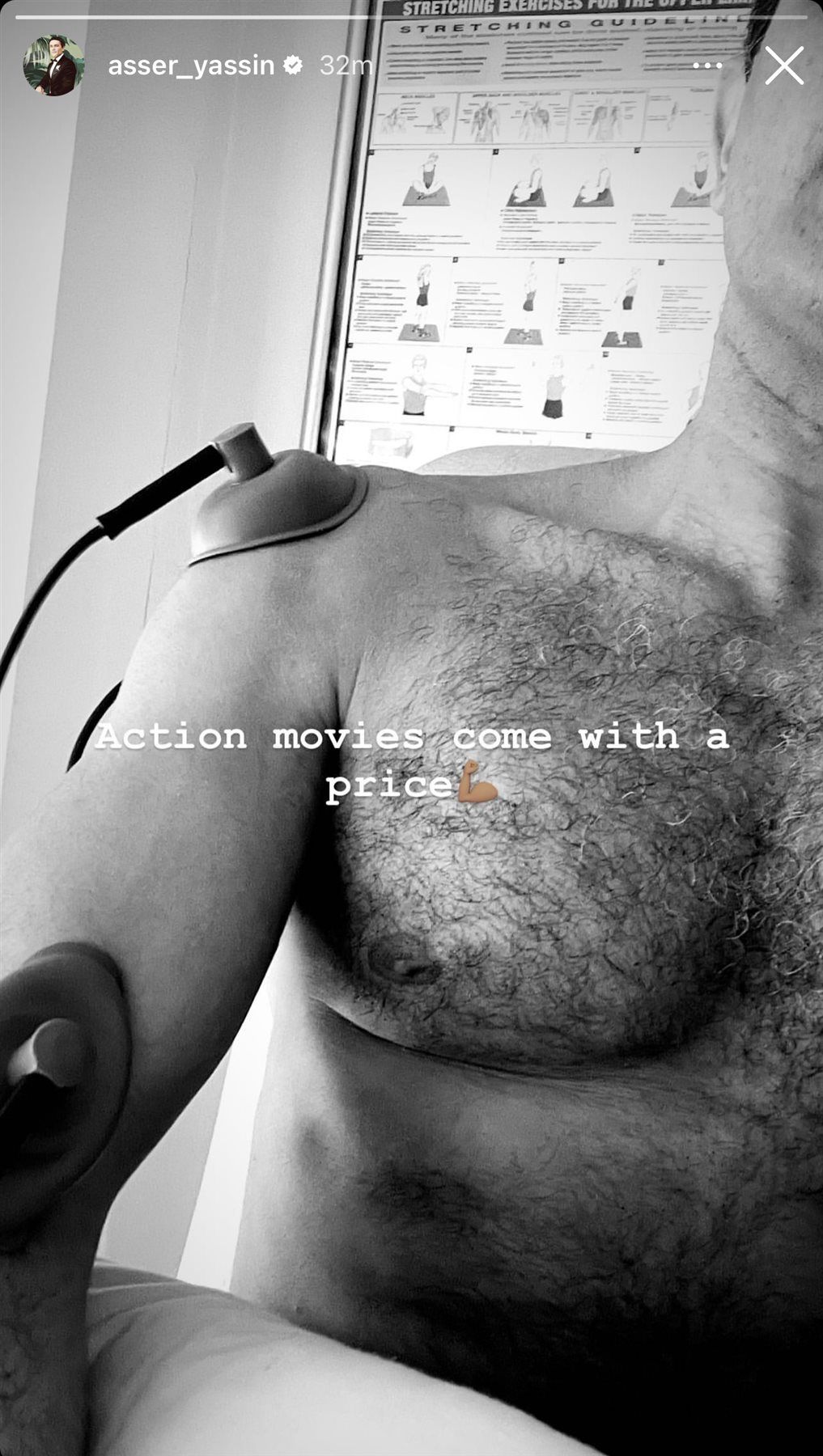 إصابة أسر ياسين بكسر في دراعه أثناء التصوير – صورة