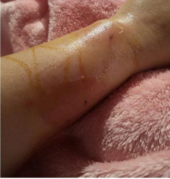 شاهد .. منى إش إش طليقة ماجد المصري تستنجد بعد تعرضها لعارض صحي-بالصور