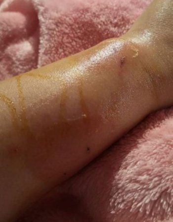 شاهد .. منى إش إش طليقة ماجد المصري تستنجد بعد تعرضها لعارض صحي-بالصور