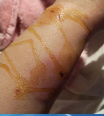 شاهد .. منى إش إش طليقة ماجد المصري تستنجد بعد تعرضها لعارض صحي-بالصور