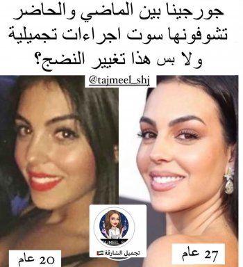 شاهد .. صورة نادرة لـ جورجينا رودريغز قبل خضوعها للتعديلات التجميلية