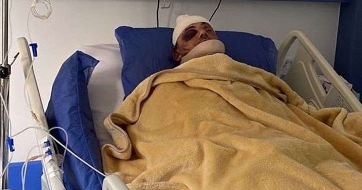 شاهد .. بعدما تعرض لـ كسور في الجمجمة وبترت إحدى أذنيه...سمير صفير يخرج عن صمته