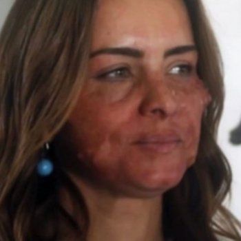 شاهد .. نور اللبنانية تظهر بملامح مشوهة.. وتحدث حالة من الجدل- بالصور