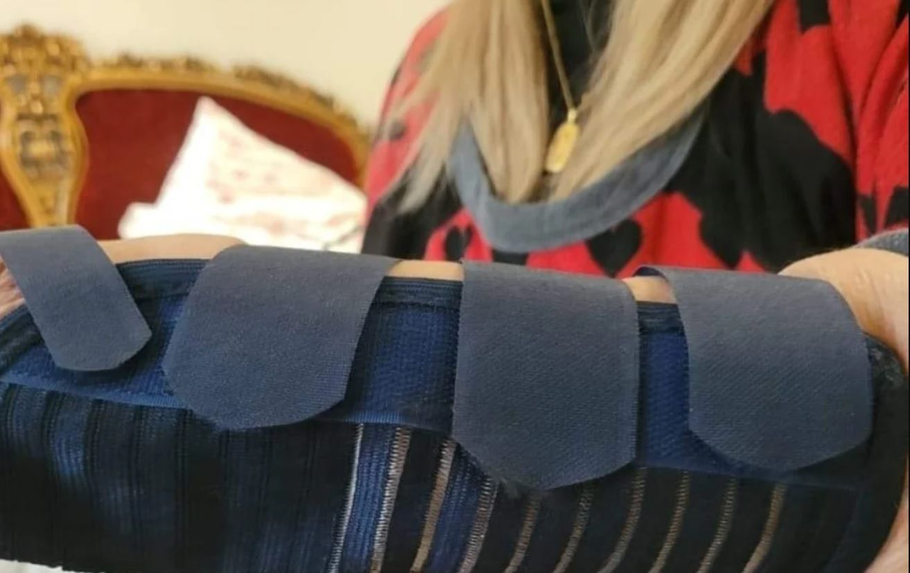 بالصور – شهيرة تتعرض لإصابة في اليد بعد سقوطها