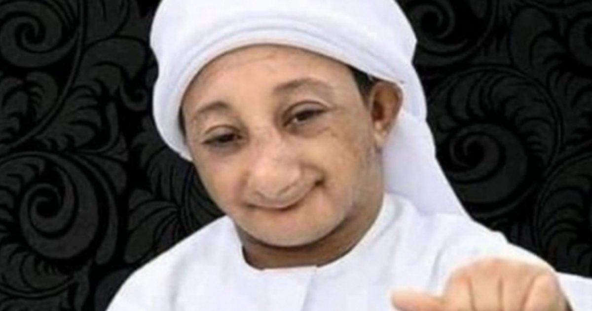 شاهد .. الكشف عن سبب وفاة عزيز الأحمد.. وما هو مرضه النادر؟