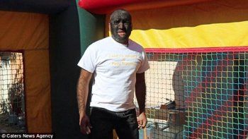 شاهد .. بالصور - يغطي 98% من جسده... أكثر رجل مشعر في العالم