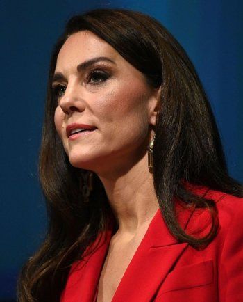 شاهد .. كايت ميدلتون تتعرض للانتقادات بسبب هذا العيب بوجهها.. ظهر لأول مرة- بالصور