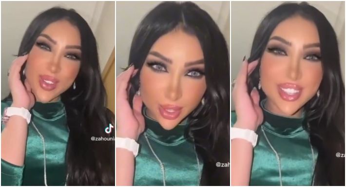عملية تجميل ولا فلتر : دنيا بطمة هتجنن الجمهور