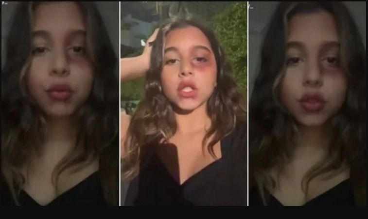 الجمهور خايف علي بنت شيرين : أنتي في سن خطر فين مامتك ؟!!