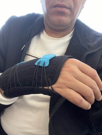 شاهد .. مصطفى كامل يتعرض لإصابة في يده-بالصورة