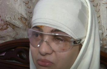 شاهد .. بالصور - هكذا تبدو ساره محمد بعد أن تعرضت لحادث مريع وفقدت بصرها