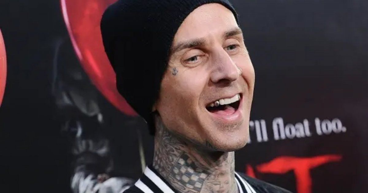 شاهد .. ترافيس باركر يخضع لعملية جراحية ويظهر بضمادات-بالصورة