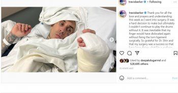 شاهد .. ترافيس باركر يخضع لعملية جراحية ويظهر بضمادات-بالصورة