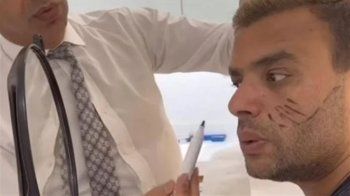شاهد .. رامي صبري يخضع لعملية تجميل في الوجه