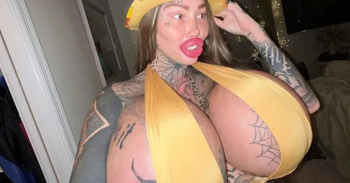 شاهد .. بالصورة - هذا ما فعلته ماري مجدلين بعد إنفجار ثديها